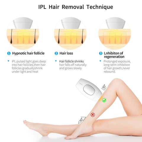 IPL Laser Hair Removal - uberskin